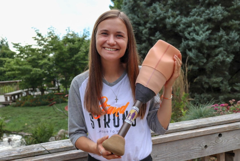 image of a girl holding a prosthetic leg